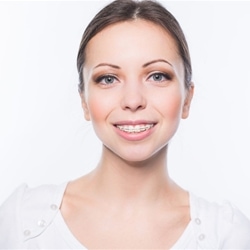 young lady with clear ceramic braces