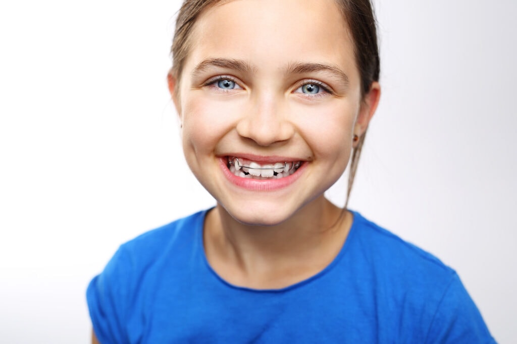 Smiling young girl wearing palatal expander